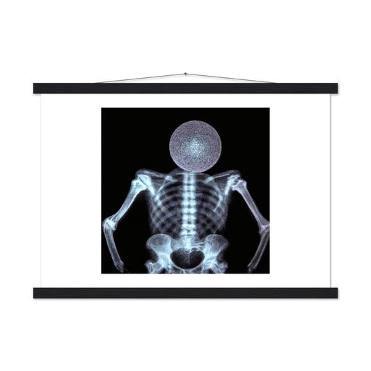X-ray Disco Head Classic Matte Paper Poster with Hanger